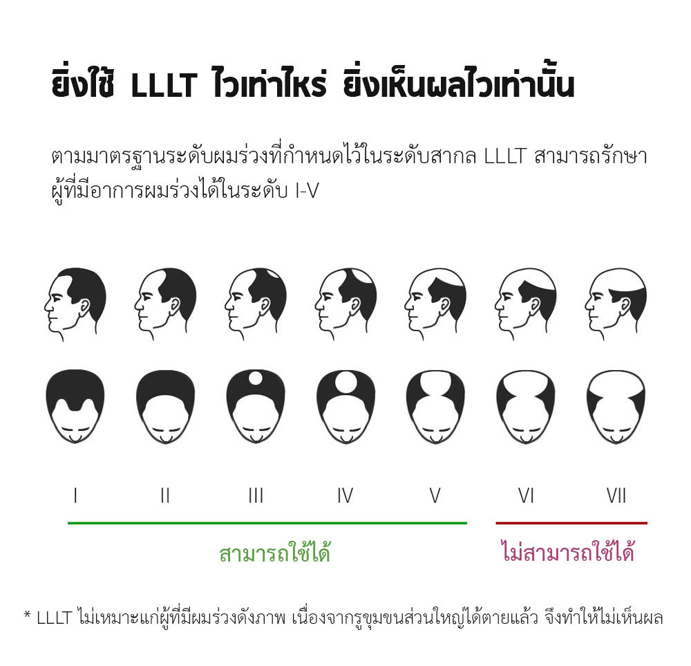 Xiaomi COSBEAUTY Peninsula Laser Hair Growth Cap - หมวกเลเซอร์ปลูกผม