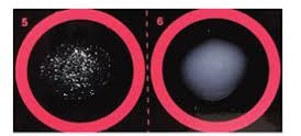 Rheumatoid Factor "Crypress"100t