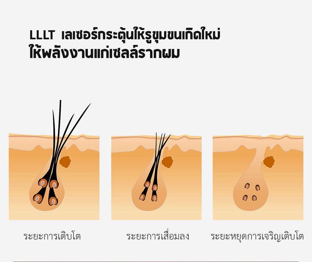 Xiaomi COSBEAUTY Peninsula Laser Hair Growth Cap - หมวกเลเซอร์ปลูกผม
