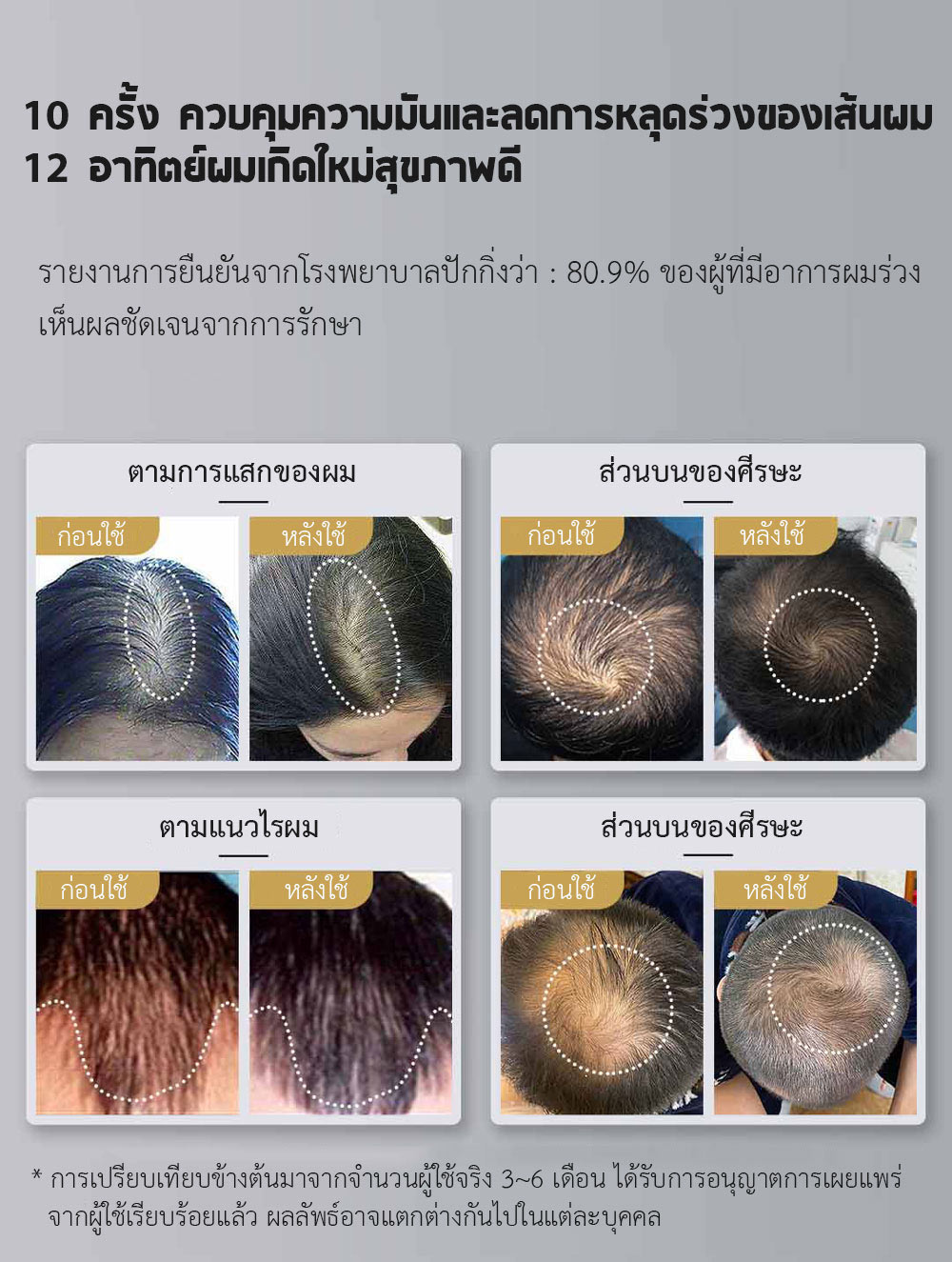 Xiaomi COSBEAUTY Peninsula Laser Hair Growth Cap - หมวกเลเซอร์ปลูกผม