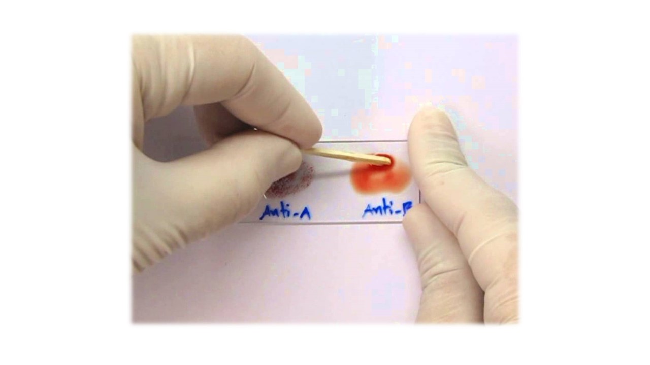 Anti - D 10 ml.