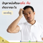 ปัญหาหนังศีรษะแห้ง คันเกิดจากอะไร