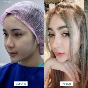 รับงานศัยกรรม โทร 095-5266242 เสริมหน้าอก เสริมจมูก ทำตา2ชั้น สำหรับผู้หญิงเรา ต้องสวย เพราะความสวยจะเปลี่ยนชีวิตc